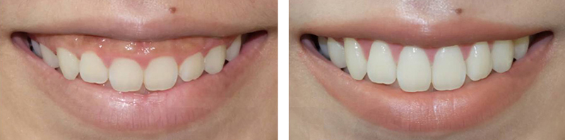 لبخند زیبا دندانپزشک