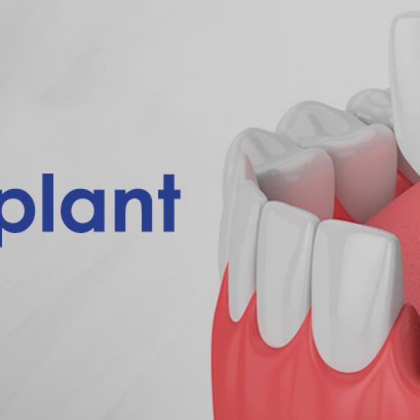 Dental Implant Conditions