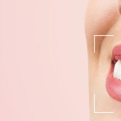 اصلاح طرح لبخند